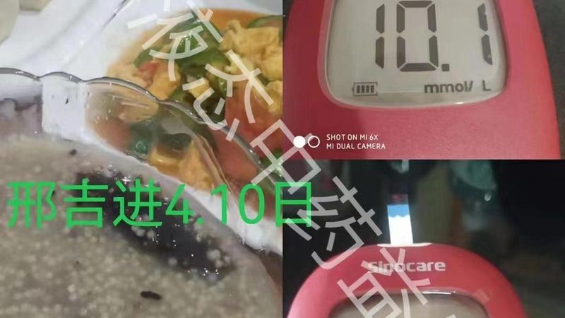 复合维生素与单一维生素：营养补充的差异化选择